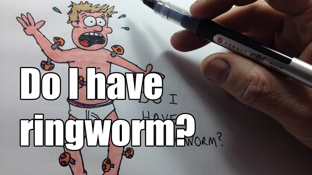Do I have ringworm? YouTube