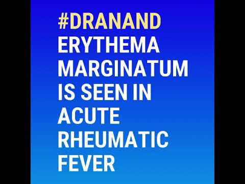 Video: Erythema Marginatum: Cēloņi, Attēls, ārstēšana Un Citi