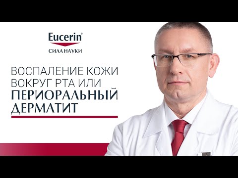 Воспаление кожи вокруг рта или периоральный дерматит