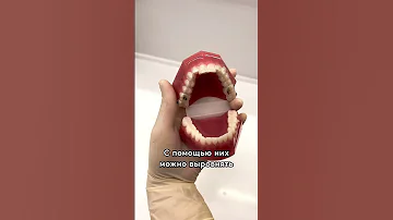 Ровные зубы без брекетов это реально❓🤔