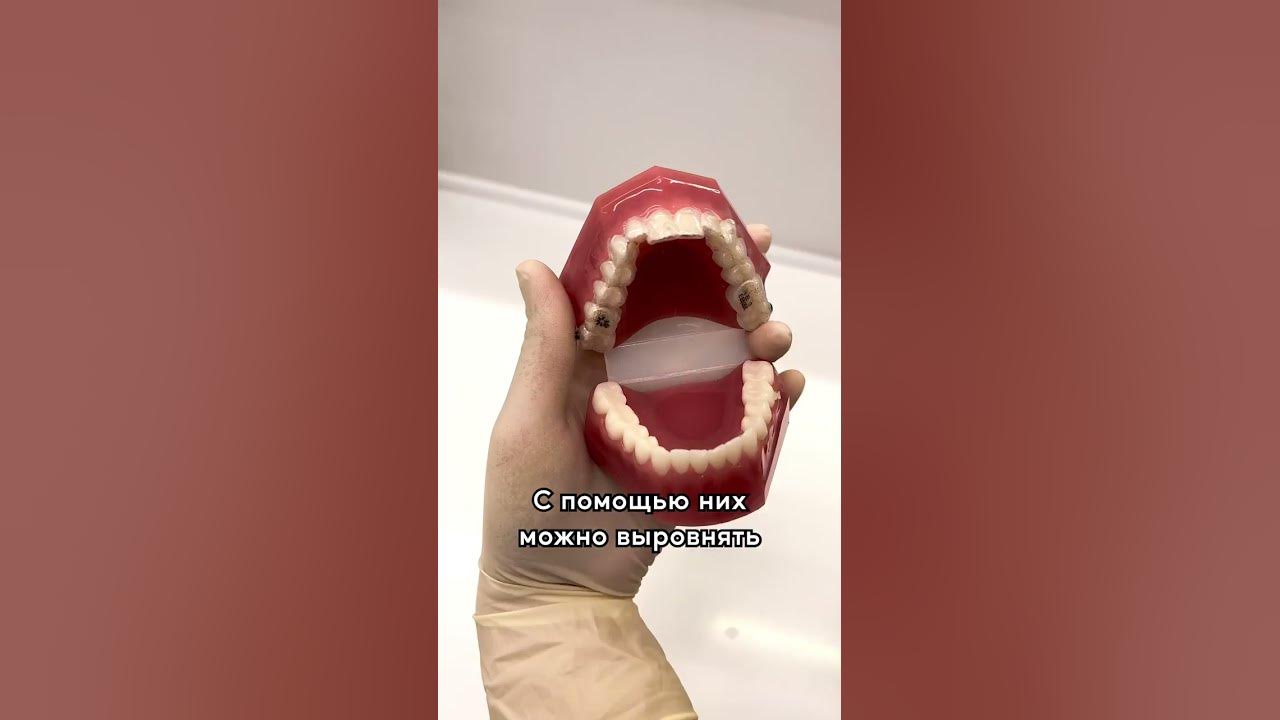 Ровные зубы без брекетов это реально 🤔 - YouTube