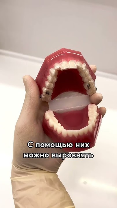 Ровные зубы без брекетов это реально 🤔 - YouTube