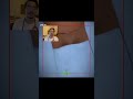 عملية الولادة القيصرية قصي سامر 