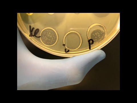 Пятничные Кейсы #7. Клебсиеллы - подробный микробиологический разбор. Метод работы с бактериофагами