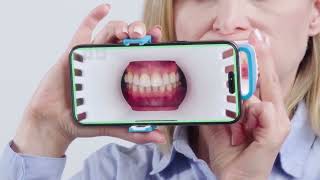 Invisalign Virtual Care