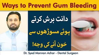 Prevention From Gum Bleeding | Danton Se Khoon Kyun Ata Hai? | Right Way To Brush Your Teeth