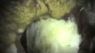Horse Gold Inc Stomach Scope Ulcer Video.m4v