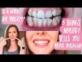 INVISALIGN 5 THINGS NOBODY TELLS YOU? INVISALIGN TIPS! WORTH THE COST? SHOCKING BEFORE/AFTER!