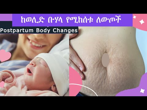 ቪዲዮ: ልጅ ከወለዱ በኋላ የሚስብ ሆድ እንዴት እንደሚወገድ