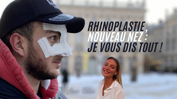 RHINOPLASTIE, NOUVEAU NEZ : JE VOUS DIS TOUT !