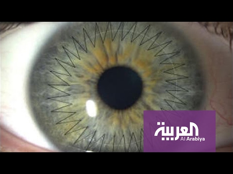 صباح العربية: زرع قرنية العين بالليزر في دقائق