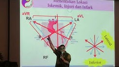 cara mudah BELAJAR EKG  #,ACUT CORONARY SYNDROME part 4 2019 - Durasi: 19.27. 