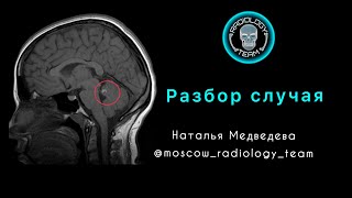 РАЗБОР СЛУЧАЯ 8 / МРТ / НАТАЛЬЯ МЕДВЕДЕВА / MOSCOW RADIOLOGY TEAM