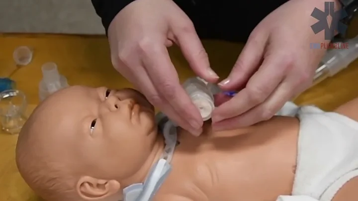 Heat Moisture Exchanger (HME) with Tracheotomies (1)