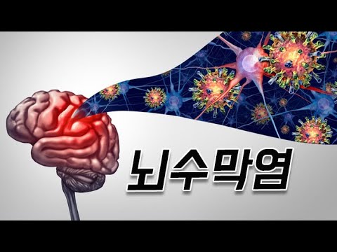 수막구균 접종 해야하나요?