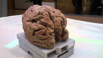 3D Brain from X-ray Computed Tomography, Printed