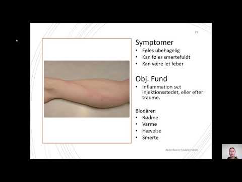 Video: Øjenlåg Dermatitis: Årsager, Behandling, Symptomer Og Mere