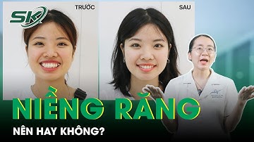 Niềng răng nên hay không? 4+ những biến chứng của niềng răng