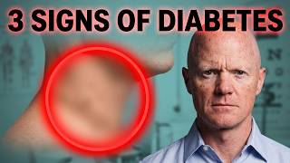 Hidden Signs of Diabetes - everyone needs to know - BEN BICKMAN