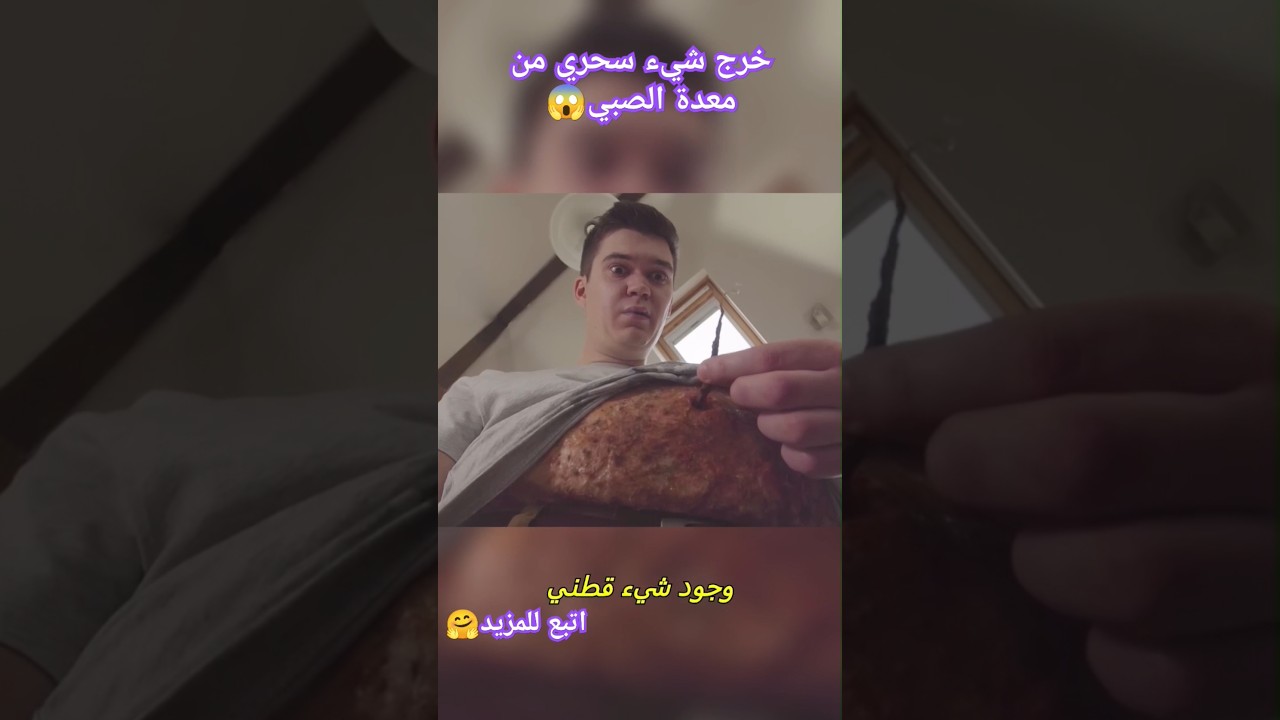 خرج شيء سحري من معدة الصبي#افلام #shorts