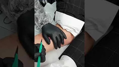 Come si fa la scarificazione?
