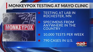 Monkeypox testing begins at Mayo Clinic in Rochester