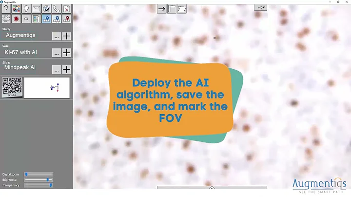 Semi-automatic AI  - Digital Pathology - Automatic Reporting
