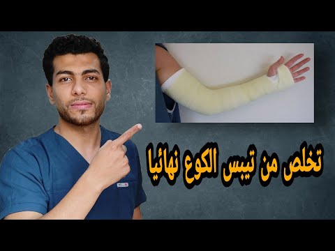 فيديو: 3 طرق للاستمتاع بذراع مكسور