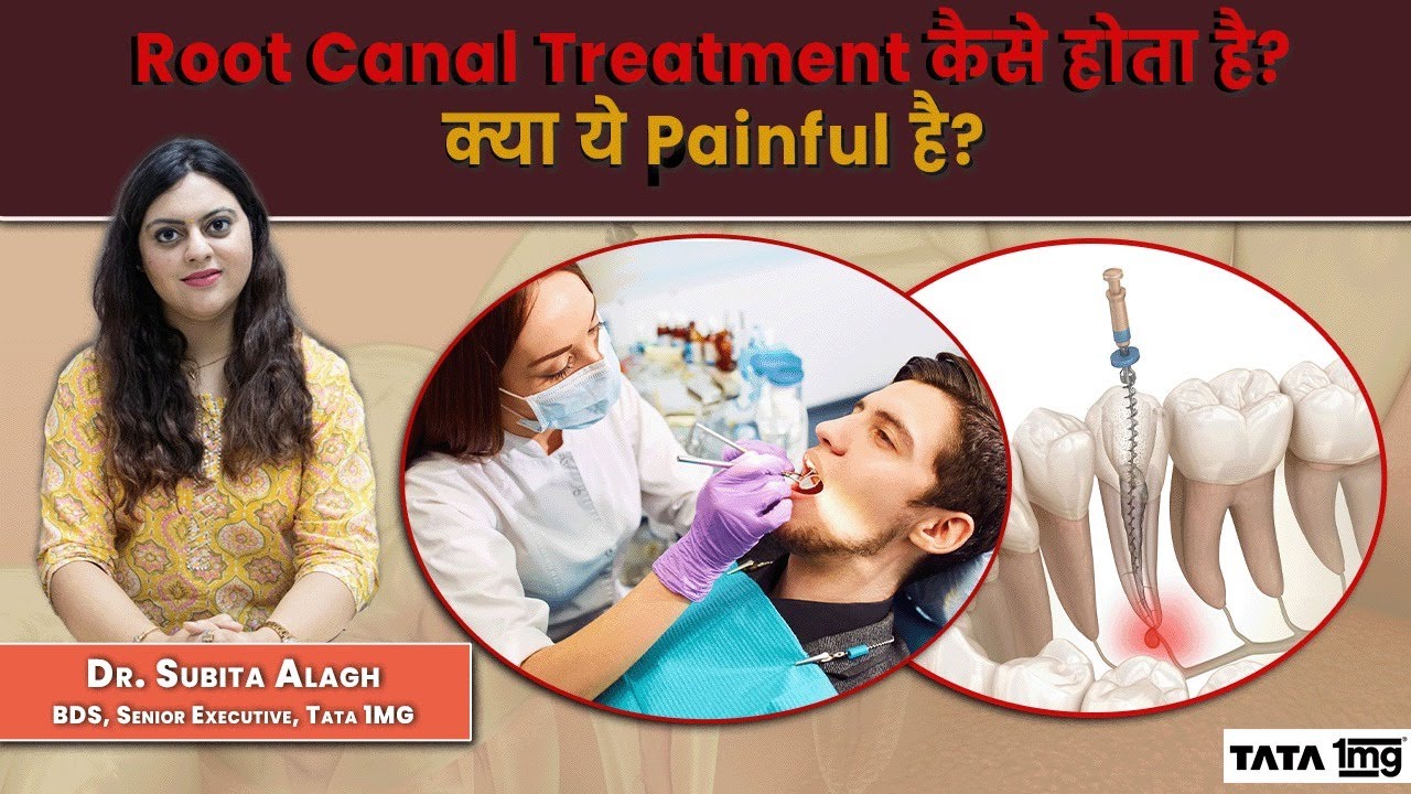 Root Canal Treatment (RCT) की ज़रुरत क्यों पड़ती है? जाने इसका ...