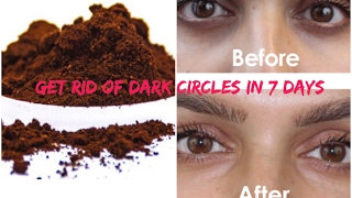 HOW TO GET RID OF DARK CIRCLES,PUFFY &BAGGY EYES | DIY COFFEE MASK | SAANVI MITTAL