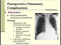Post operative Pulmonary complications | General Surgery