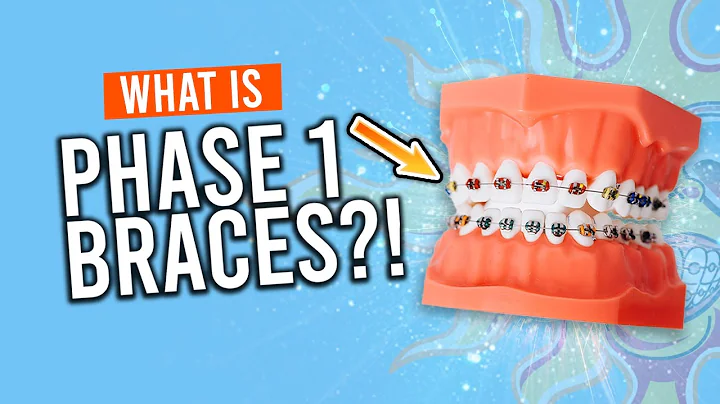 How long do Phase 1 braces take? (2023)