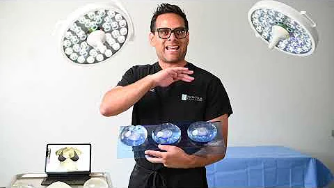 CHOOSING THE RIGHT BREAST IMPLANTS