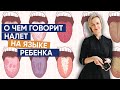 О чем говорит налет на языке ребенка