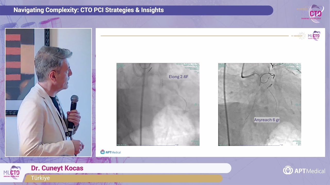 New toolkit for CTO and CHIP patients: Anyreach CTO wires and Elong MC - Dr. Cuneyt Kocas (Türkiye)