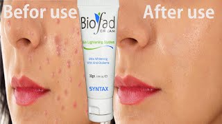 Biofad cream for skin lightening system and pimple skin honest review