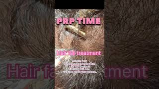 best treatment for hair fall skincare beauty shortvideo viral trending shortvideo doctor..