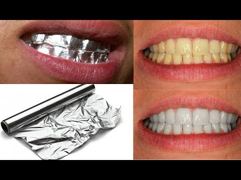 Cubre Tus Dientes Con Papel De Aluminio Por 15 Minutos Para Blanquear Tus  Dientes - YouTube