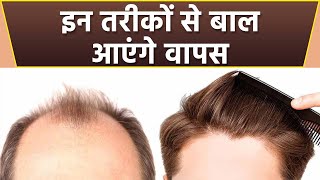 गंजापन दूर करने के आसान उपाय | Best Hair Loss Solution | Boldsky *health