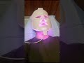 7 Steps HydraFacial At Evon Aesthetic Center G 10 Markaz Islamabad Hydrafacial Skincare Blackhead 7 Steps HydraFacial At Evon Aesthetic Center G 10 Markaz Islamabad Hydrafacial Skincare Blackhead