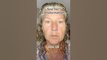 Face Transformation | Face Fitness | Face Yoga | Face Massage