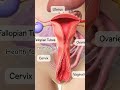 Female Pelvic floor Anatomy #anatomy #shortvideo #pelvichealth#positivebirth#fertilization#pregnant