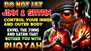 Ultimate Ruqyah to Cut Roots of Black Magic which is passed in Generations Old & Strong