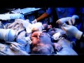 Rachit birth video (Norvic international hospital) Kathmandu Nepal)