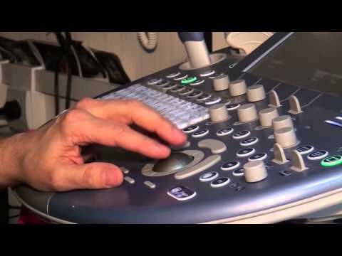 ექიმი რადიოლოგ-გინეკოლოგი, სერგო მათითაშვილი ფოლიუმის მჟავის ნაკლებობის შესახებ