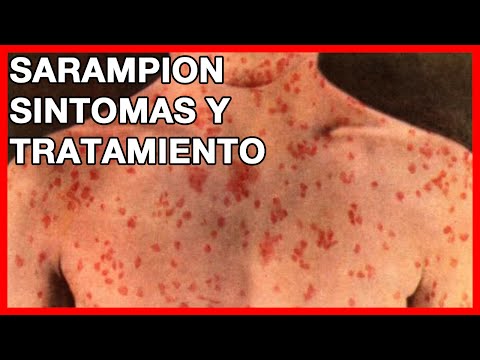 Vídeo: Síndrome De Trastorn Respiratori Agut (SRAD) En Gossos