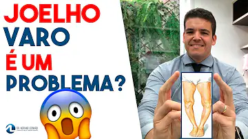 Porque minha perna e torta?