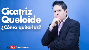 ¿Cómo eliminan los dermatólogos los queloides?