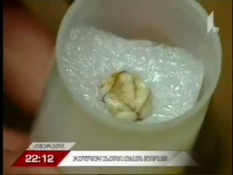 50 000 წლის წინანდელ ნეანდერტალელთა სამოსახლო ცუცხვათის მღვიმოვანში