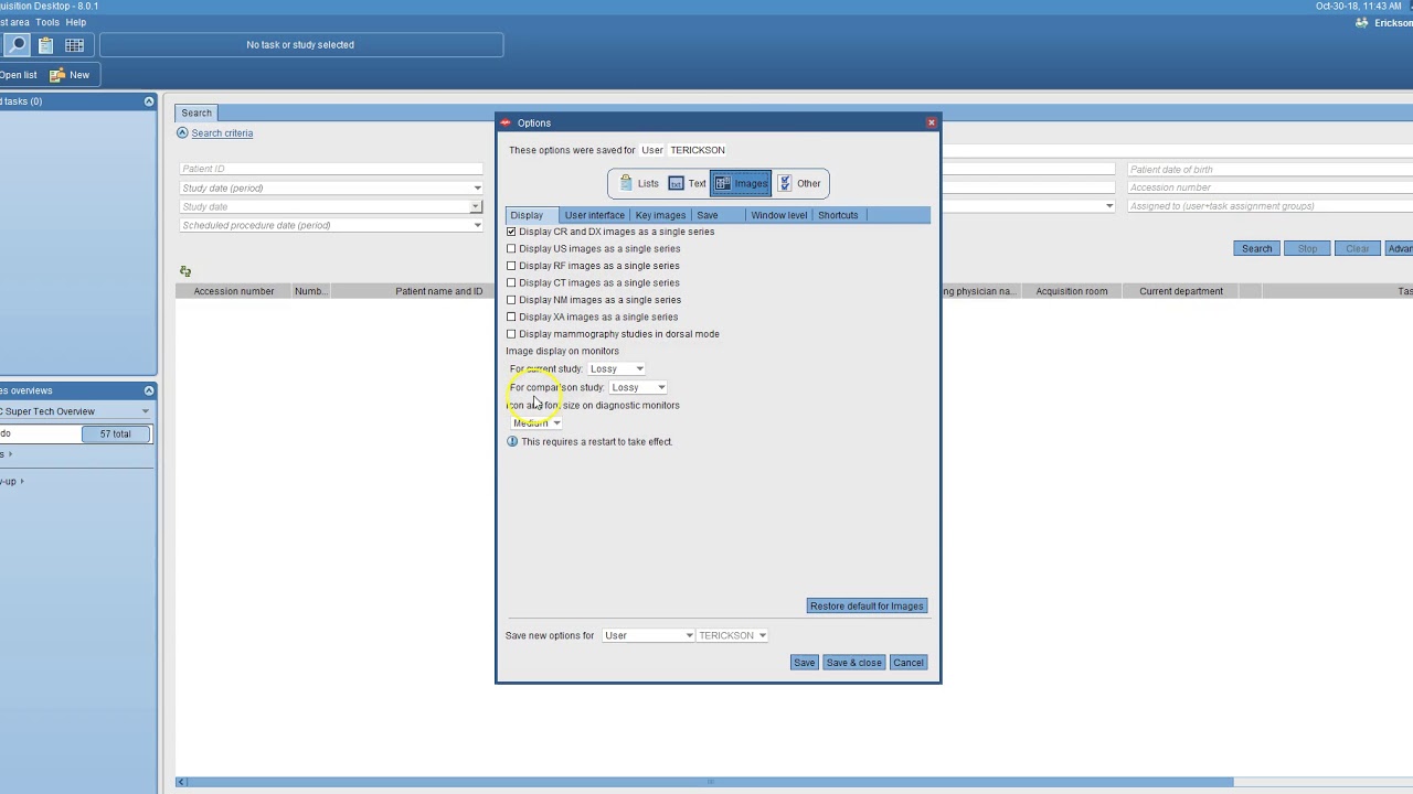 Compression settings in PACS - YouTube